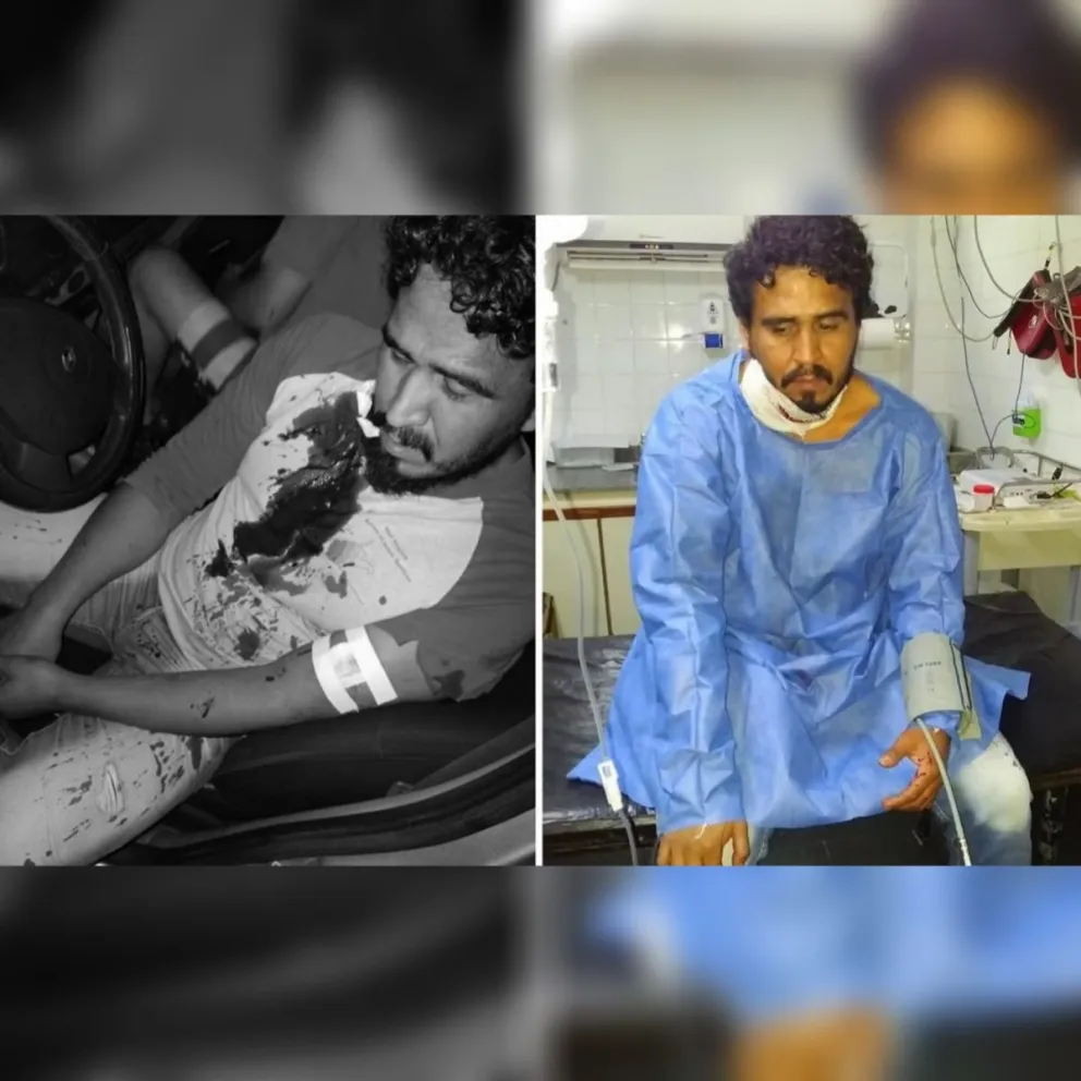 Con nombre y apellido: identifican al joven que quiso matar a cuchillazos a un conocido periodista salteño