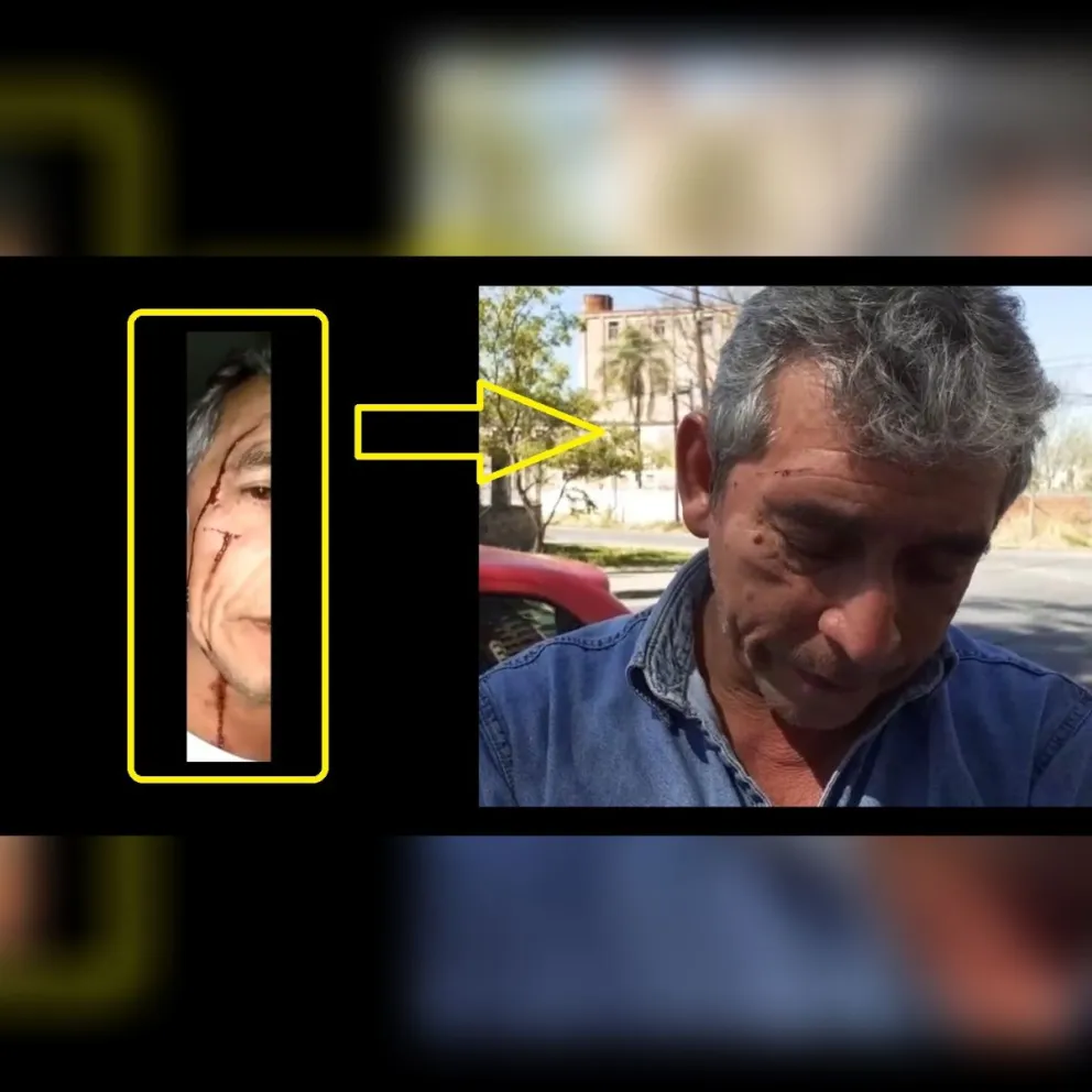 |TERRIBLE VIDEO| El calvario de un taxista salteño: con lágrimas y ensangrentado tras un cuarto robo en el año