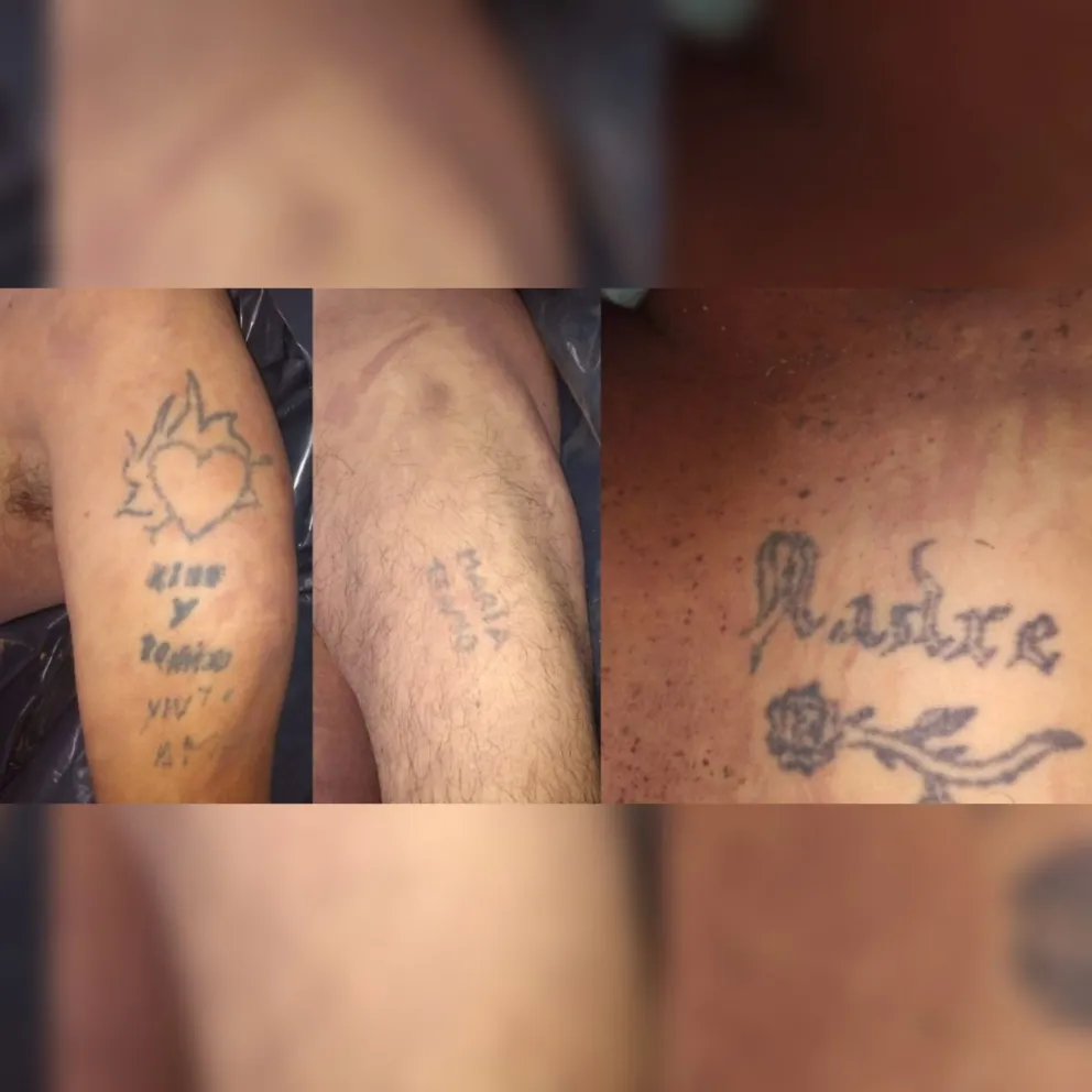 Fin del misterio: confirman quién era y de qué murió la persona hallada sobre calle Leguizamón