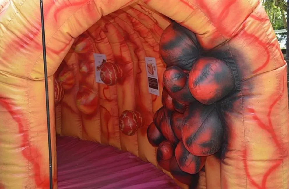 Instalarán un colon gigante en el Hospital del Milagro: ¿Qué significa esta intervención?
