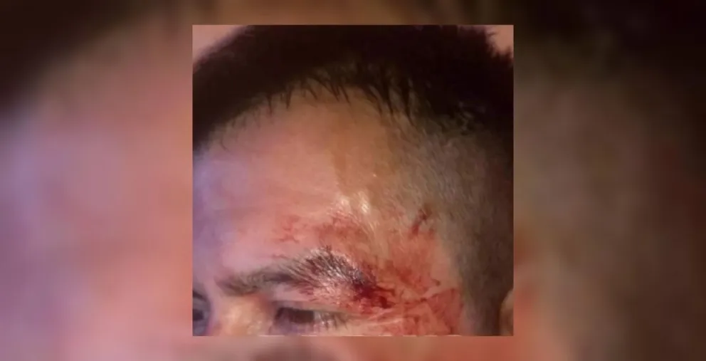 "Lo que tenemos que aguantar": salteño fue a comprar pan y lo abrieron como campera