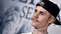 |IMÁGENES SENSIBLES| Justin Bieber confesó que sufre un síndrome facial