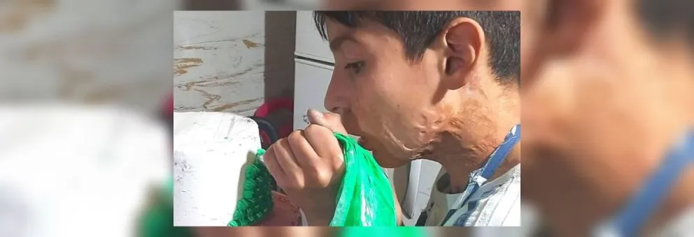 Joaquín: el salteñito que superó la adversidad, hace tortas para ayudar a sus padres y sueña a lo grande