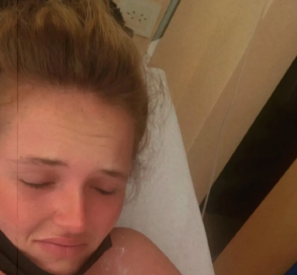 |FOTOS| Impactante: una mujer fue a la cama solar y le pasó algo terrible