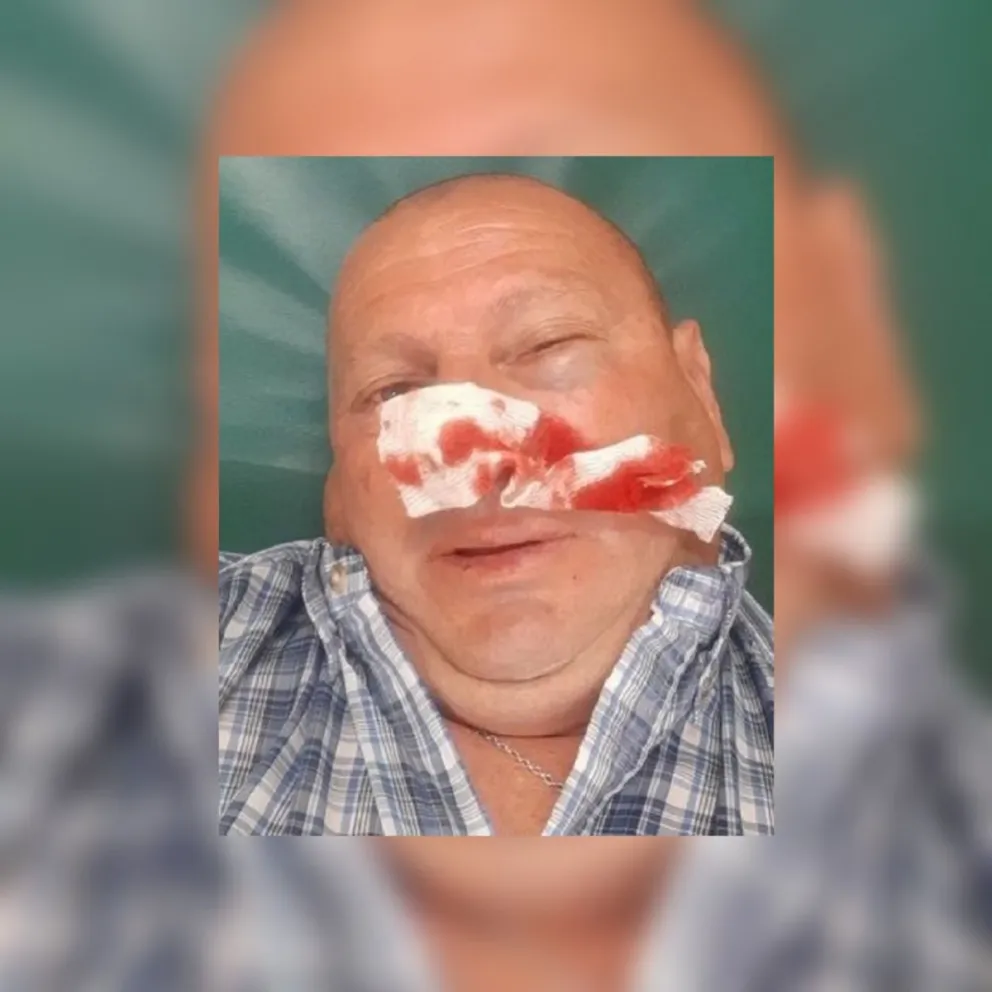 Revelan detalles sobre el brutal ataque al periodista salteño: terminó en el hospital tras la paliza