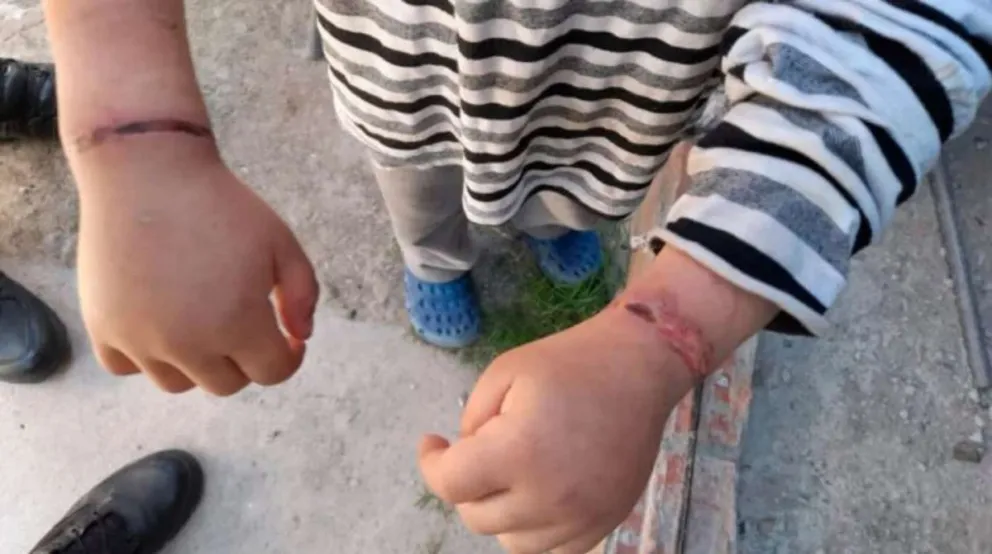 Dos hermanitos que sufrían abuso y maltrato fueron recatados gracias a la denuncia de un vecino