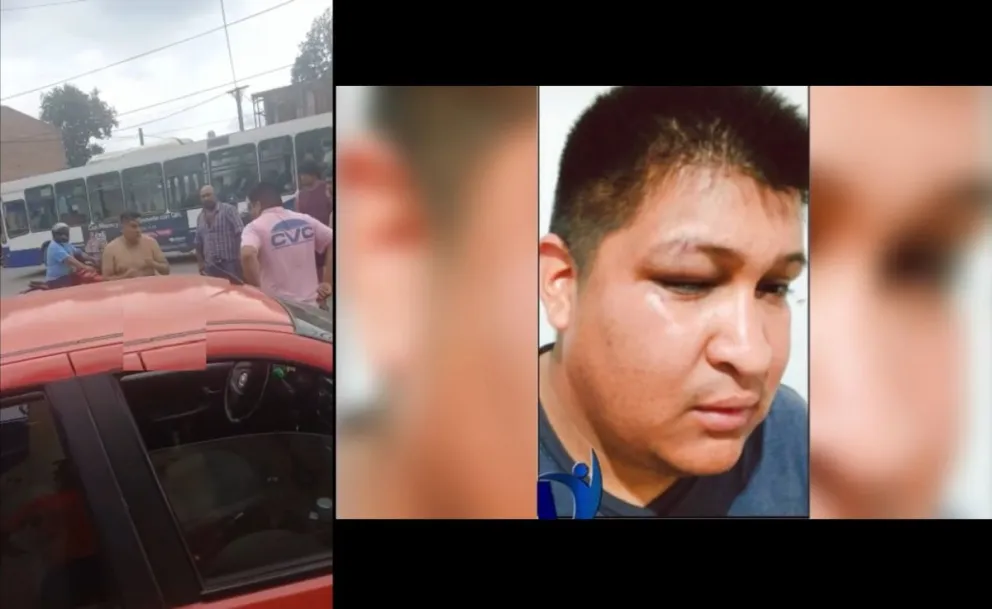 |TERRIBLE VIDEO| Así fue el brutal ataque que recibió un taxista que quería trabajar en la Terminal
