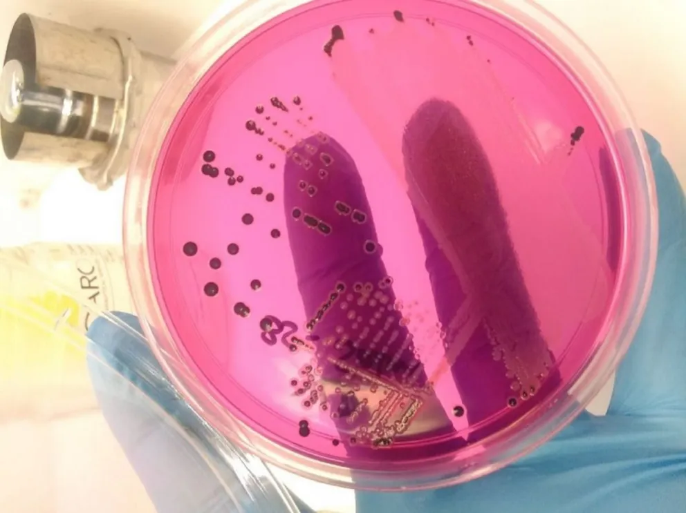 Golpea la salmonelosis en Salta: más de 1200 casos y casi la mitad son niños