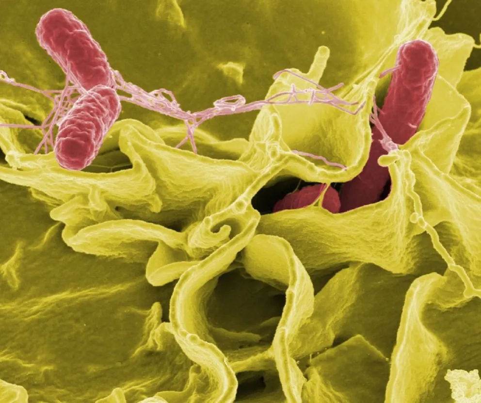Salmonella en Salta: hallan el virus en los tanques de agua de dos conocidos clubes de Rugby