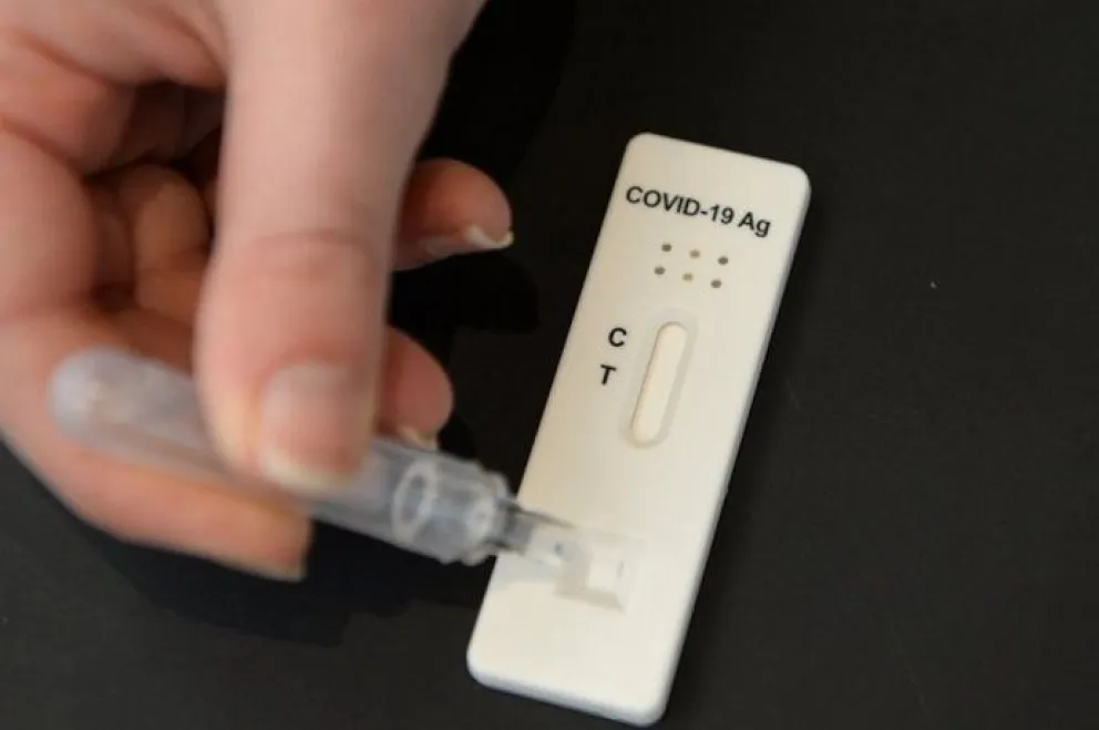 Autotest de covid: Podrían comenzar a comercializarse en farmacias a partir de enero