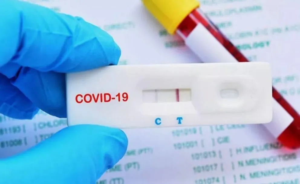 Se empezaría a comercializar el autotest de coronavirus en Salta