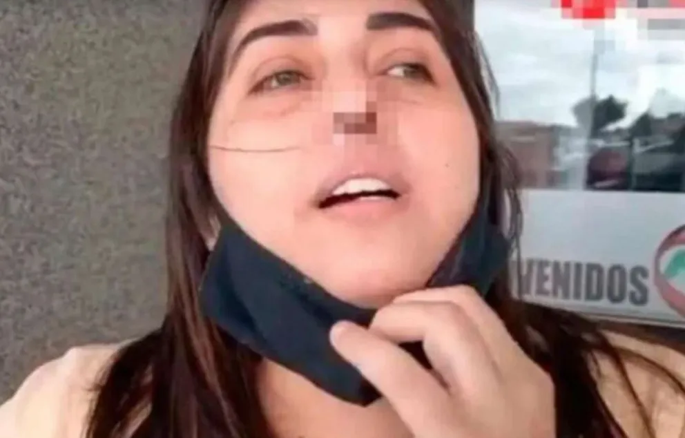 El calvario que vive una mujer tras un hisopado mal hecho: “Puede subir al cerebro y puedo morir”