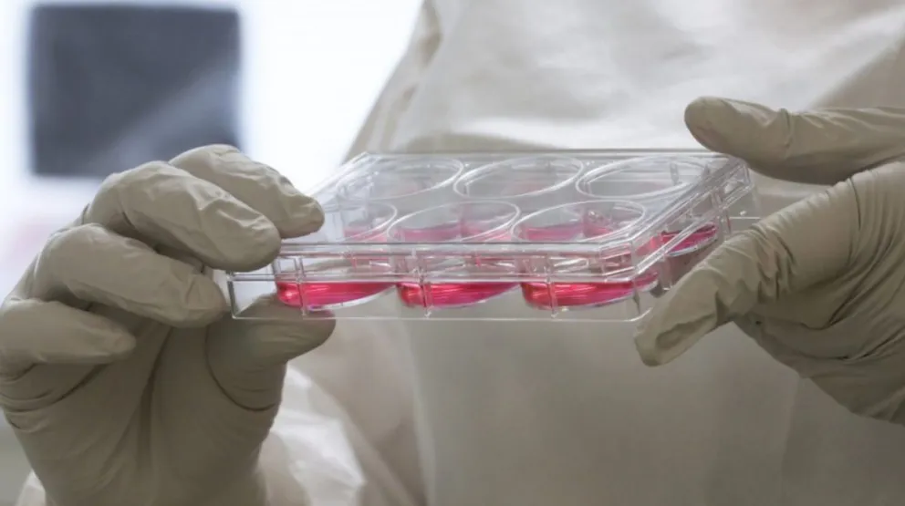 Estalló la salmonella en Salta: nuevo récord de casos en un solo mes 