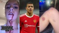 Las fuertes imágenes que involucran a un jugador del Manchester United con un caso de violencia de género