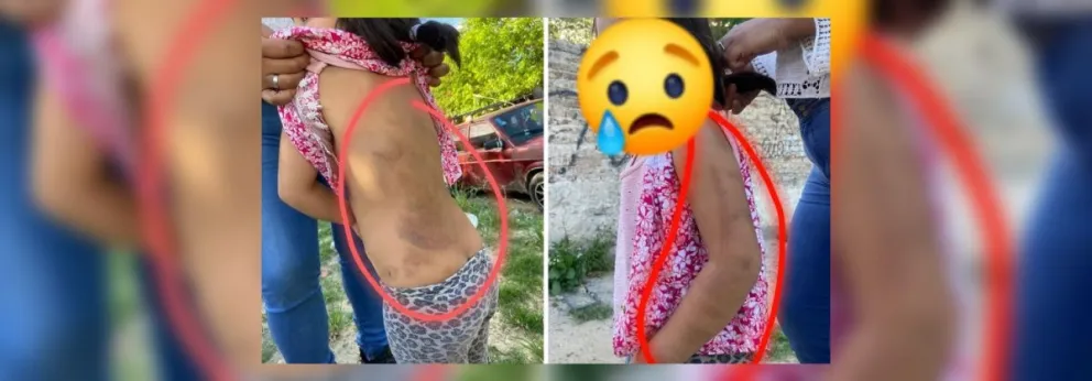 "No quiero un Lucio más en mi familia": la desgarradora denuncia de maltrato infantil que consterna a todos