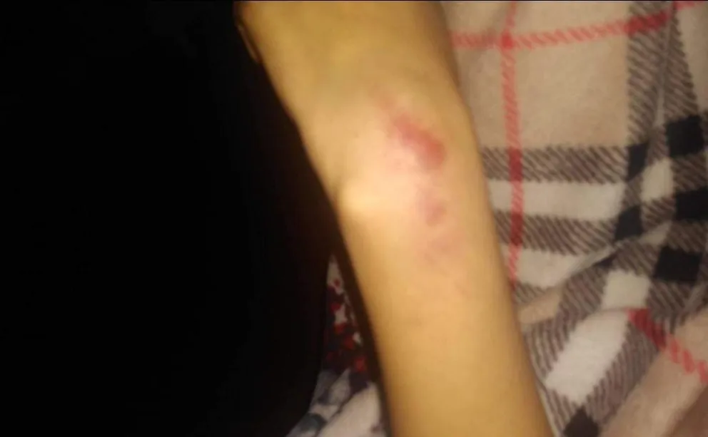 Joven cuenta como fue brutalmente atacada en La Carpa de las Estrellas