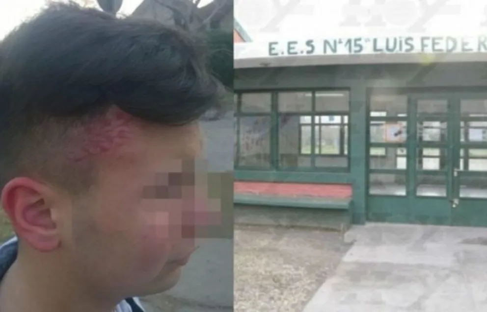Un alumno le fracturó el cráneo a otro para robarle el celular