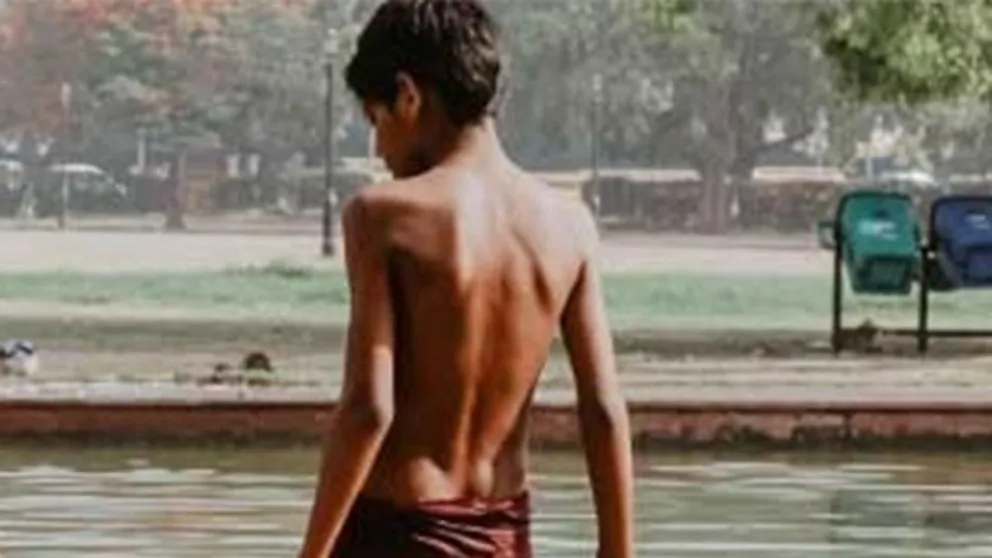Insólito motivo: tiene 24 dedos y su familia quiere matarlo. Enterate porqué