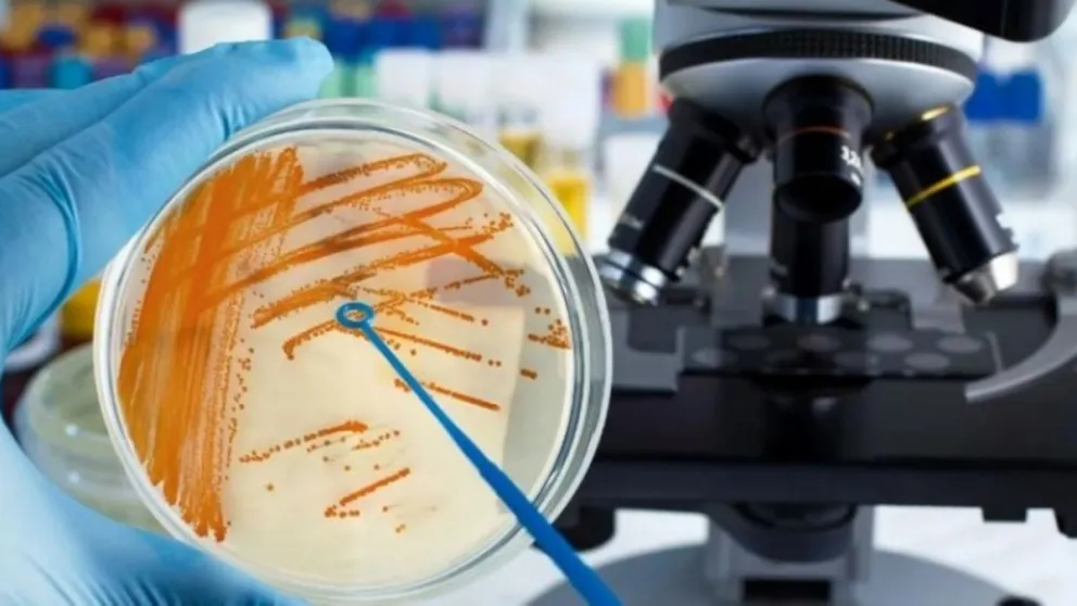 La bacteria mortal ahora se cobró la vida de un adulto