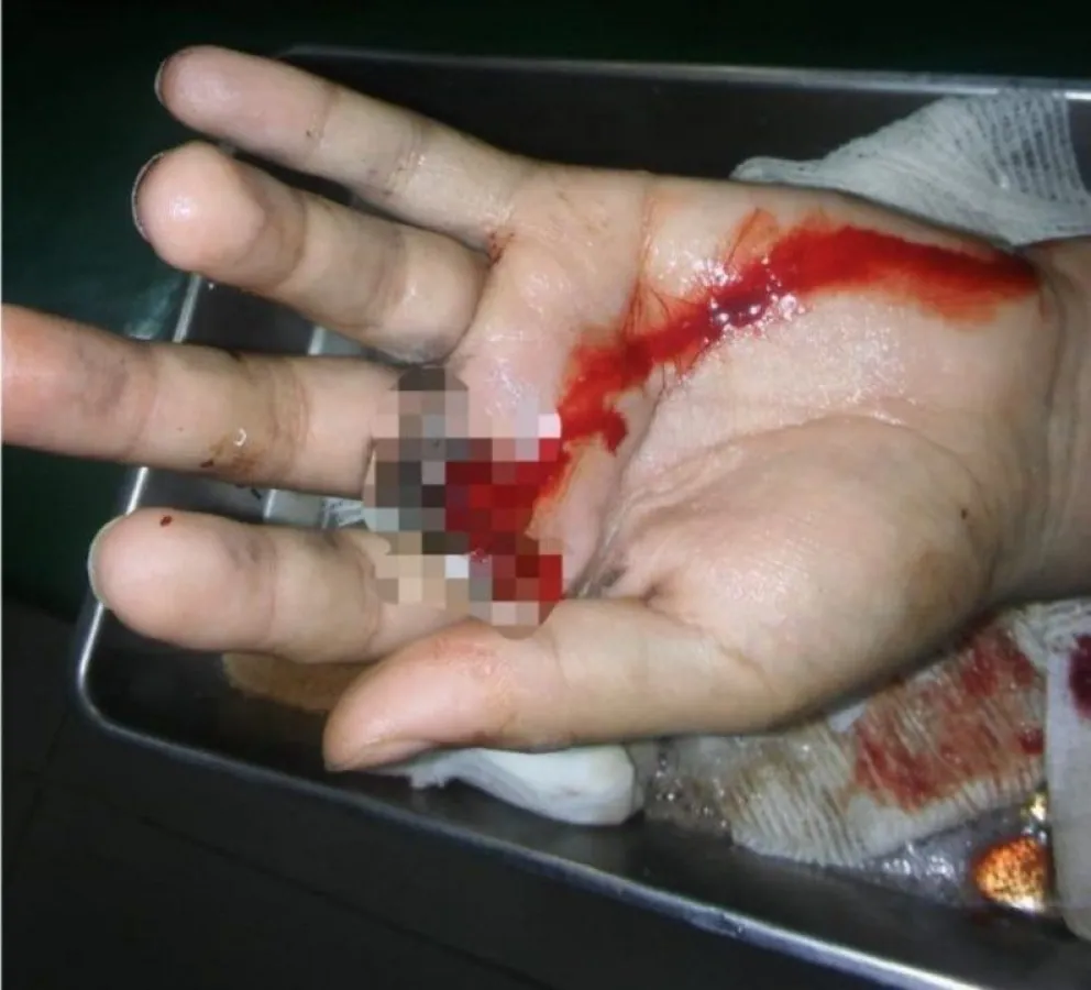 Policía salteño se disparó la mano con el arma reglamentaria