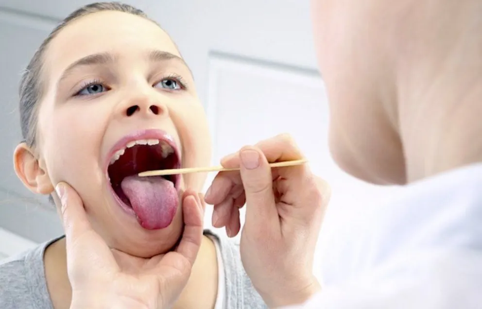 Combinación letal de estreptococo y gripe: dos chicos murieron. Lo que hay que saber