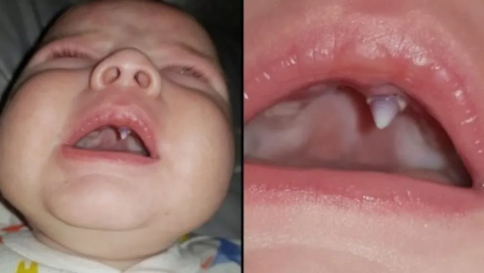 El bebé 'vampiro” que es furor en las redes , increíbles fotos