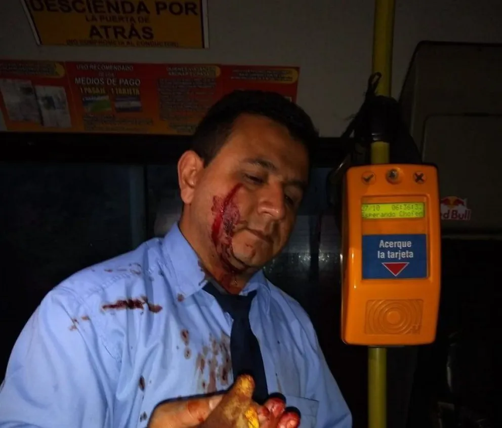 Le cortaron los dedos a un chofer de colectivo durante un violento asalto