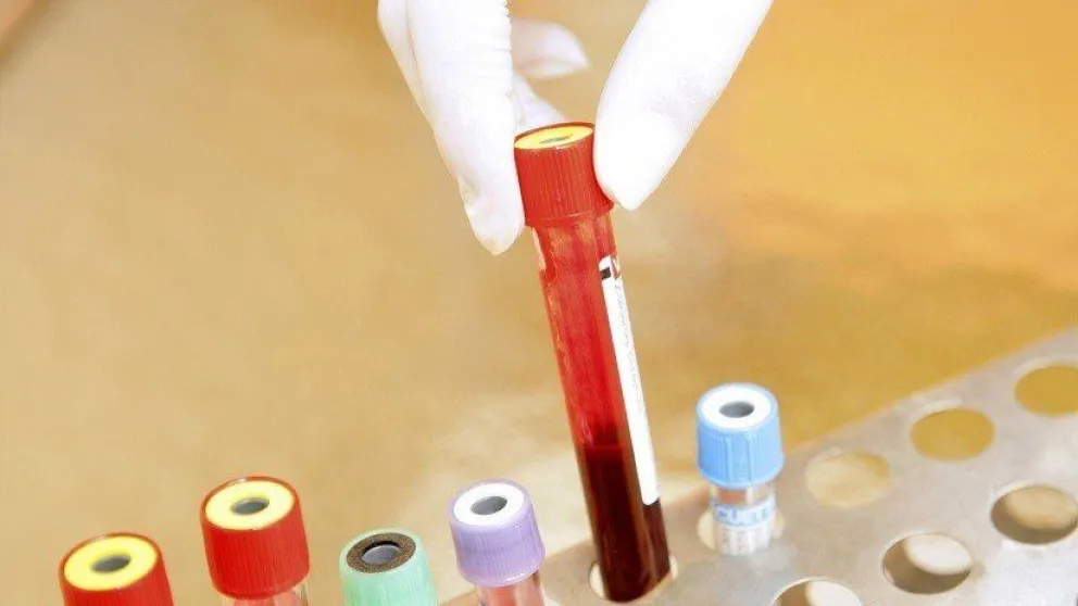 Descubren un modo para eliminar las células infectadas por el VIH