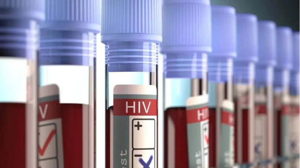 VIH, virus del sida: encuentran la forma de eliminar células infectadas