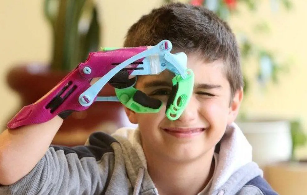 Buenas noticias: nuevo modelo de prótesis 3D al alcance de todos