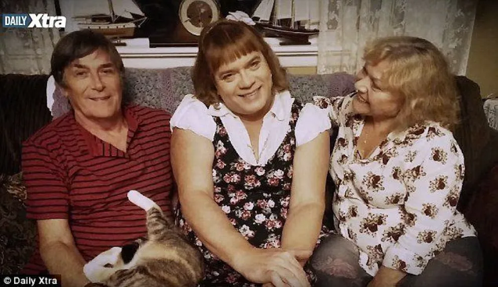 Tiene 52 años pero se transformó en una niña de seis años