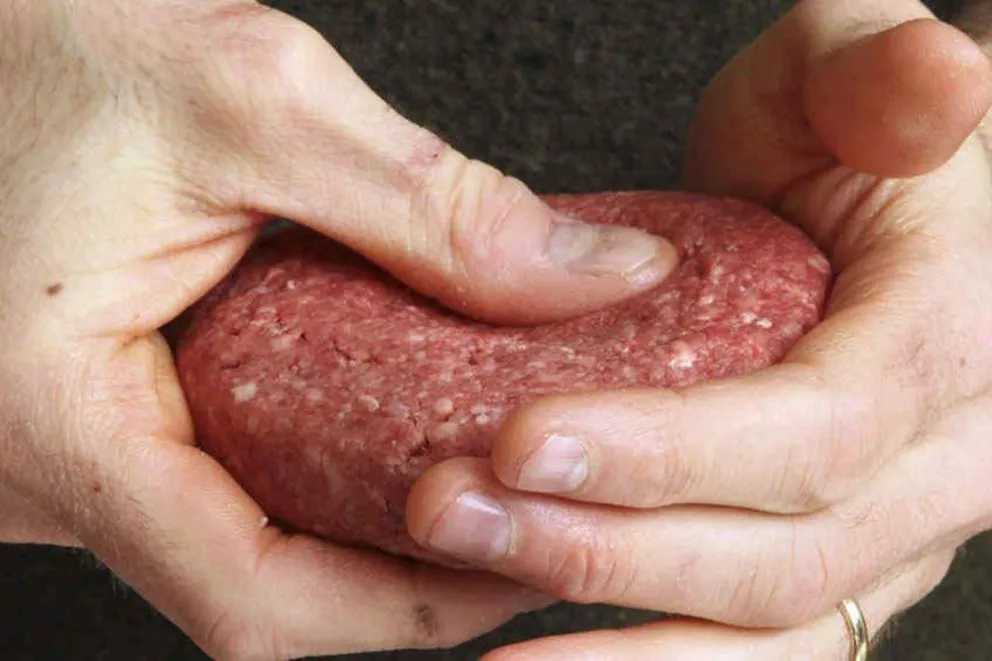 Ojo con el síndrome 'mal de la hamburguesa”: estas son las recomendaciones del Hospital Materno Infantil
