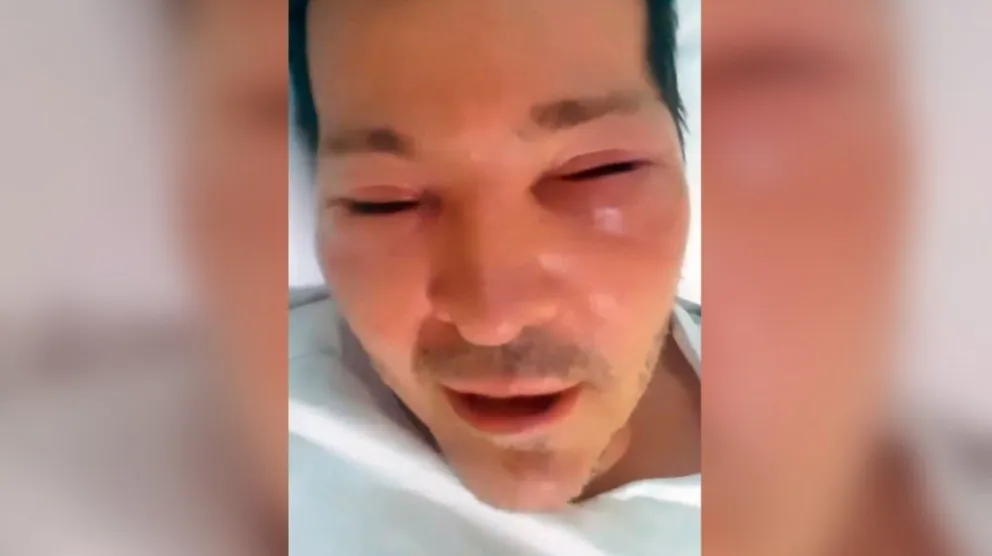Internaron a Guido Süller: impresionante video con la cara desfigurada
