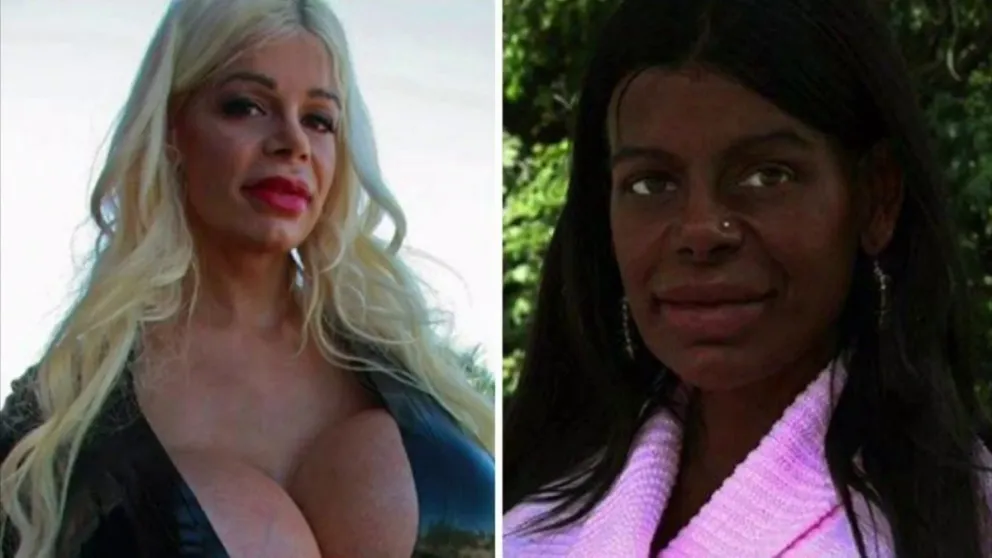 Modelo alemana se volvió negra tras una serie de tratamientos