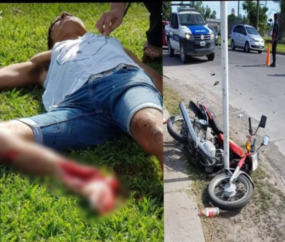 Mirá cómo quedaron los motochorros salteños que chocaron contra un auto cuando huían