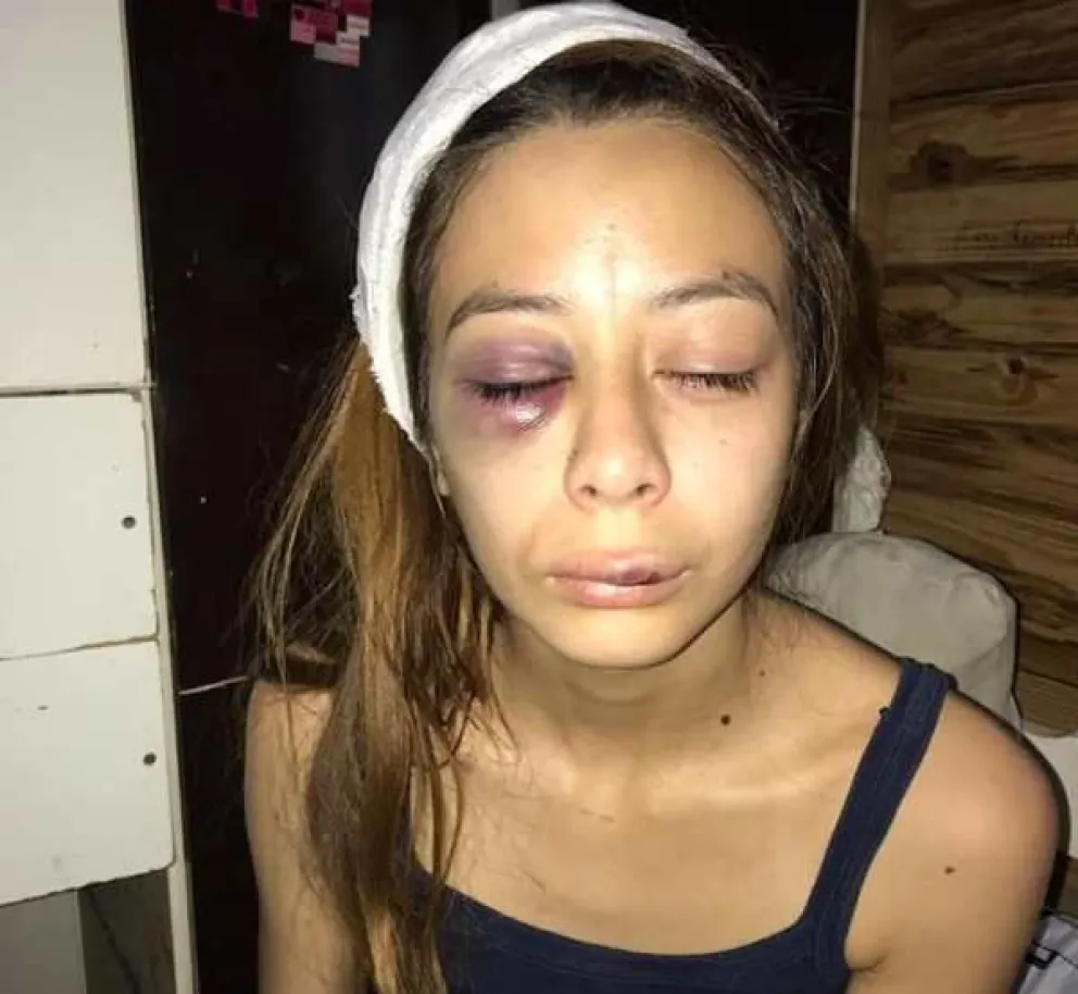 El malviviente que golpeó a su pareja hasta desfigurarla está por tener su merecido