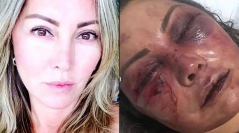 Horror en una cita: lo conoció a través de las redes sociales, y en el primer encuentro la sometió a 4 horas de golpes, mordiscos e insultos