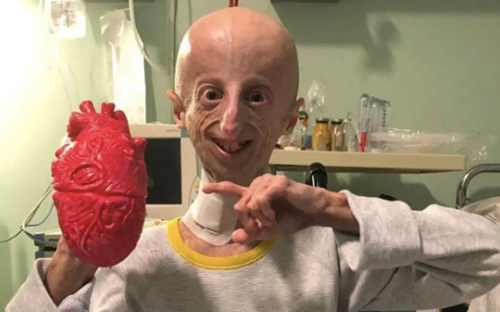La historia de Sammy Basso, el científica que se resiste a envejecer y busca una cura