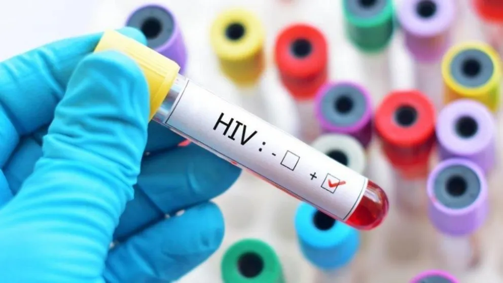 Anuncian que un tercer paciente fue curado del HIV