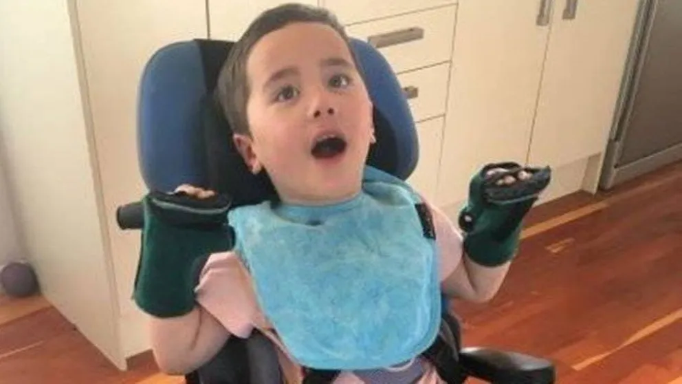 Nene de 2 años se atragantó con una manzana y quedó paralítico