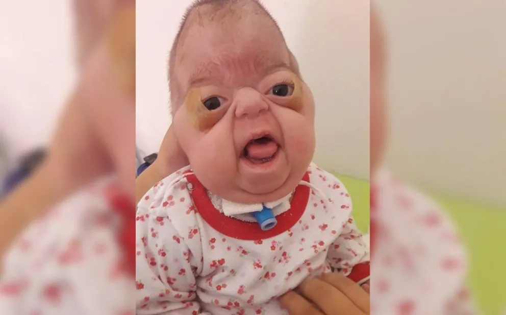 Una bebé tucumana nació con una extraña condición: necesita ayuda