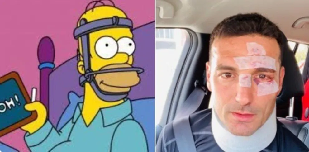 Luego del accidente de Scaloni estallaron los memes