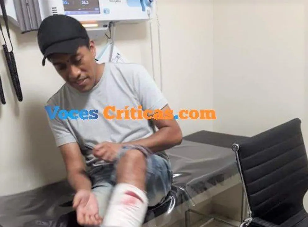 VIDEOS Y FOTOS. "Tiraron bombas de estruendo con esquirlas fabricadas e hirieron la pierna y la cara del vicepresidente de Central Norte"