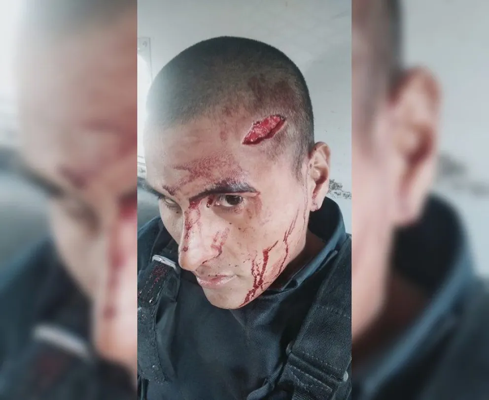 Fuerte enfrentamiento en una comisaría: los policías terminaron mal