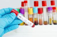 Test de VIH gratuitos: cuándo se realizarán y cómo acceder en Salta 