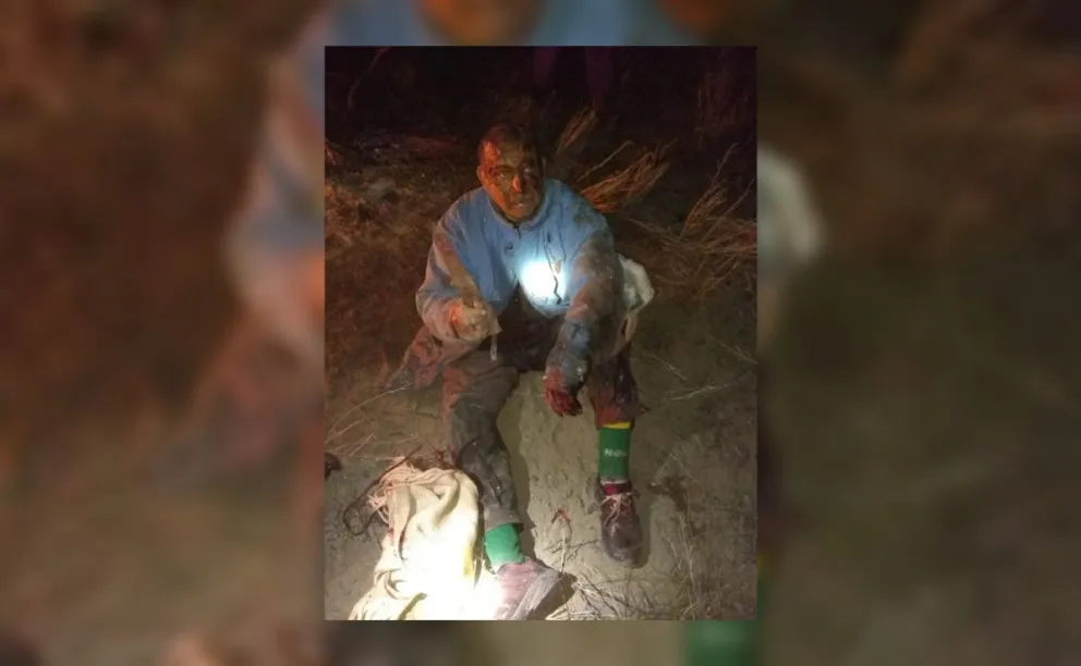 Insólito: peleó con un puma por defender a su perro