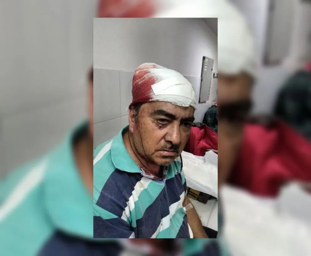 Brutal golpiza a un salteño en Bº Finca Independencia