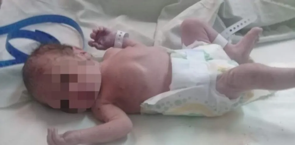 Caso del “bebé sin rostro”: el obstetra que siguió el embarazo tiene un prontuario estremecedor