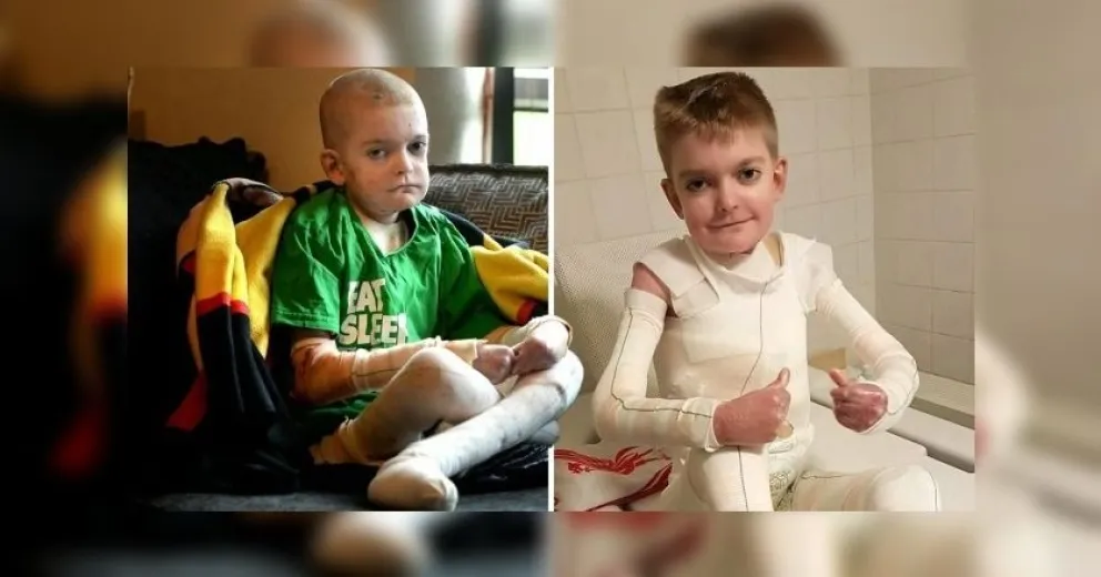 De terror: un niño de seis años agoniza todos los días