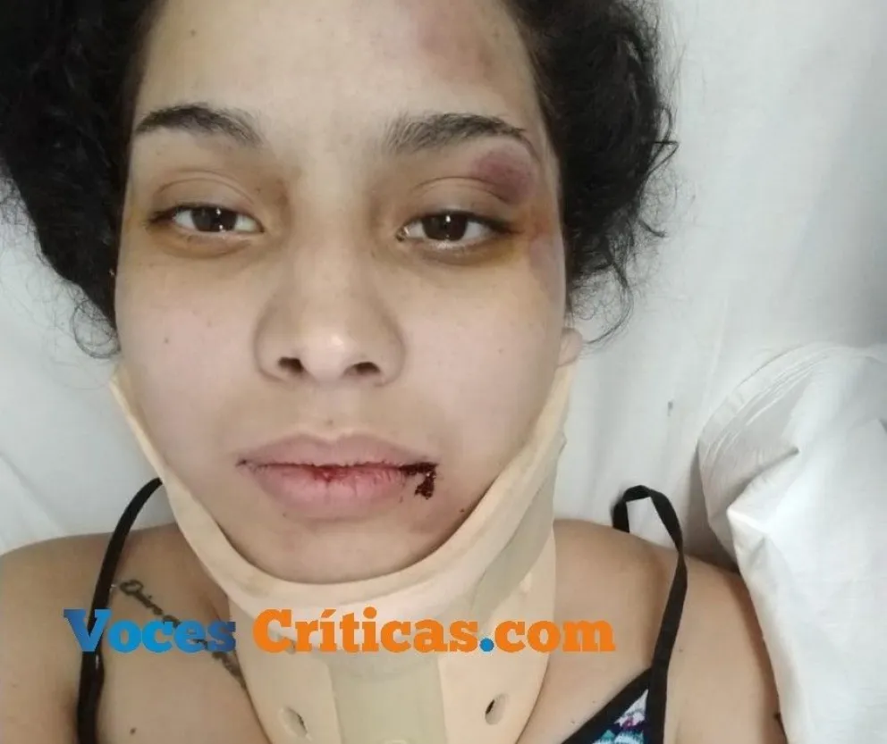 El horror indescriptible que vivió y vive la salteña Sofía Cristofani violada por un Inspector de Tránsito. FOTOS